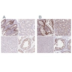 Immunohistochemical staining of human colon, kidney, liver and testis using Anti-ZC3H14 antibody HPA053510 (A) shows similar protein distribution across tissues to independent antibody HPA049798 (B).