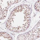 Immunohistochemical staining of human testis shows strong nuclear positivity in cells in seminiferous ducts.