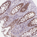 Immunohistochemical staining of human colon shows strong nuclear positivity in glandular cells.