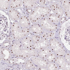 Immunohistochemical staining of human kidney shows moderate nuclear positivity in cells in tubules.