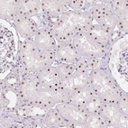 Immunohistochemical staining of human kidney shows moderate nuclear positivity in cells in tubules.