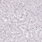 Immunohistochemical staining of human liver shows no nuclear positivity in hepatocytes as expected.