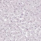 Immunohistochemical staining of human liver shows no nuclear positivity in hepatocytes as expected.