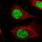 Immunofluorescent staining of human cell line U-2 OS shows localization to nucleoli & nuclear speckles.