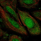 Anti-TSNAXIP1 Antibody