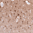 Anti-TTYH3 Antibody