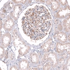 Immunohistochemical staining of human kidney shows moderate cytoplasmic positivity in cells in glomeruli and tubuli.