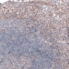 Immunohistochemical staining of human tonsil shows moderate membranous positivity in squamous epithelial cells.