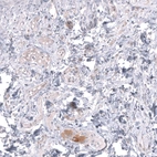 Immunohistochemical staining of human rectum shows moderate cytoplasmic positivity in peripheral ganglion cells.