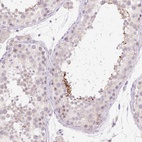 Anti-CELF6 Antibody