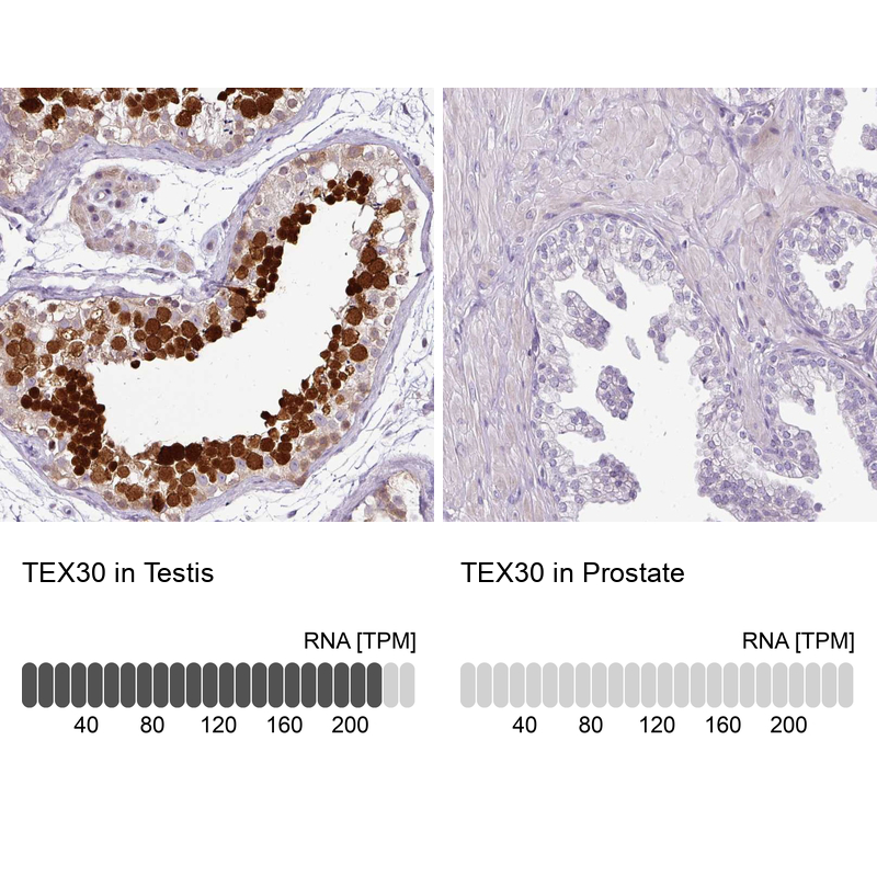 Anti-TEX30 Antibody