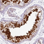 Immunohistochemical staining of human testis shows high expression.