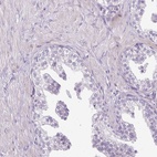 Immunohistochemical staining of human prostate shows low expression as expected.