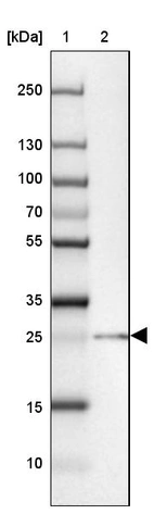 Lane 1: Marker [kDa] 250, 130, 100, 70, 55, 35, 25, 15, 10_br/_Lane 2: Human cell line MOLT-4