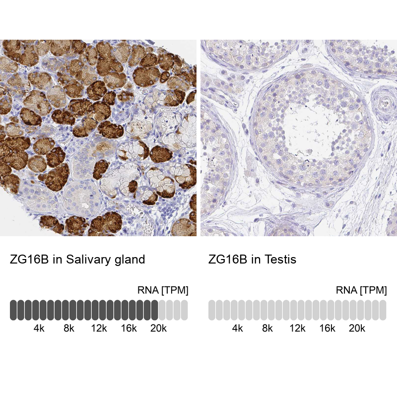 Anti-ZG16B Antibody