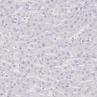Immunohistochemical staining of human liver shows no positivity in hepatocytes as expected.