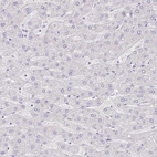 Immunohistochemical staining of human liver shows no positivity in hepatocytes as expected.