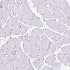 Immunohistochemical staining of human skeletal muscle shows no positivity in myocytes as expected.