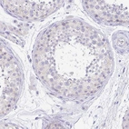 Immunohistochemical staining of human testis shows no positivity in cells in seminiferous ducts as expected.