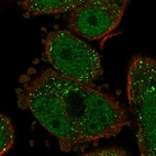 Immunofluorescent staining of human cell line PC-3 shows localization to nucleoplasm & vesicles.
