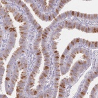 Immunohistochemical staining of human fallopian tube shows high expression.