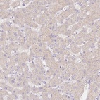 Immunohistochemical staining of human liver shows low expression as expected.