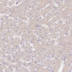 Immunohistochemical staining of human liver shows low expression as expected.