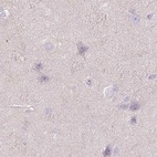 Immunohistochemical staining of human cerebral cortex using Anti-WDR54 antibody HPA053558.