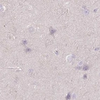 Immunohistochemical staining of human cerebral cortex using Anti-WDR54 antibody HPA053558.