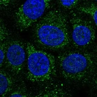 Immunofluorescent staining of human cell line MCF7 shows positivity in mitochondria & vesicles.