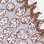 Anti-GTF2H3 Antibody