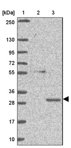 Lane 1: Marker [kDa] 250, 130, 95, 72, 55, 36, 28, 17, 10_br/_Lane 2: Human cell line RT-4_br/_Lane 3: Human cell line U-251MG sp