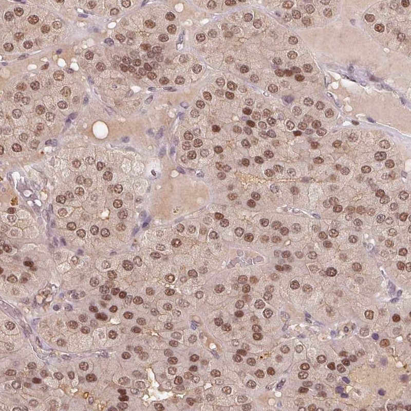 Anti-TPI1 Antibody