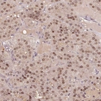 Anti-TPI1 Antibody