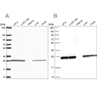Western blot analysis using Anti-TPI1 antibody HPA053568 (A) shows similar pattern to independent antibody HPA050924 (B).