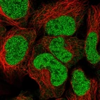 Immunofluorescent staining of human cell line HEK 293 shows localization to nucleoplasm.