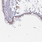 Anti-LMNB1 Antibody