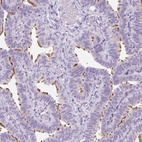 Anti-TMEM89 Antibody