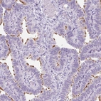 Anti-TMEM89 Antibody