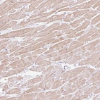 Anti-C3orf49 Antibody