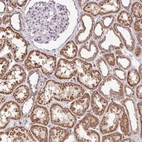 Anti-SGF29 Antibody
