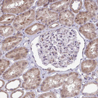 Anti-METTL9 Antibody