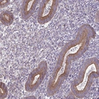 Immunohistochemical staining of human endometrium shows weak to moderate cytoplasmic and membranous positivity in glandular cells.