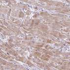 Immunohistochemical staining of human heart muscle shows weak cytoplasmic positivity in cardiomyocytes.