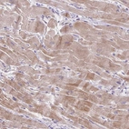 Immunohistochemical staining of human heart muscle shows weak cytoplasmic positivity in cardiomyocytes.