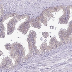 Immunohistochemical staining of human prostate shows weak membranous positivity in glandular cells.