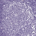 Immunohistochemical staining of human lymph node shows no positivity in germinal center cells as expected.