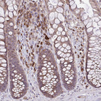 Anti-METTL9 Antibody