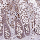 Immunohistochemical staining of human rectum shows moderate cytoplasmic positivity in lymphoid cells.