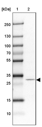 Lane 1: Marker [kDa] 250, 130, 100, 70, 55, 35, 25, 15, 10_br/_Lane 2: Human cell line SK-MEL-30